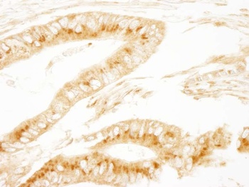 Rabbit PRKAR2A/PKA-RIIalpha Antibody