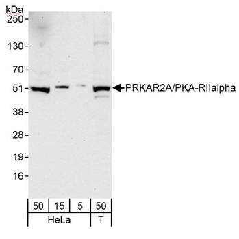 Rabbit PRKAR2A/PKA-RIIalpha Antibody
