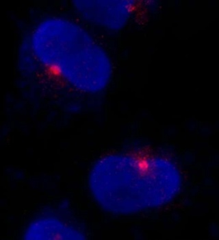 Rabbit CEP290 Antibody