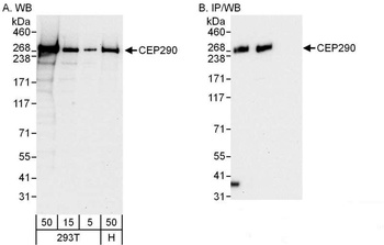 Rabbit CEP290 Antibody