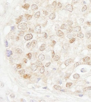 Rabbit anti-MBD4 Antibody
