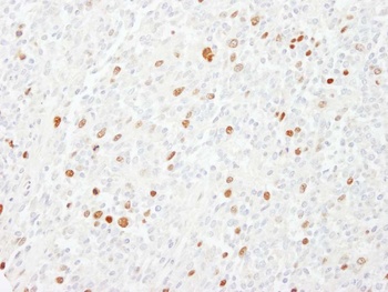 Rabbit CENP-F/Mitosin Antibody