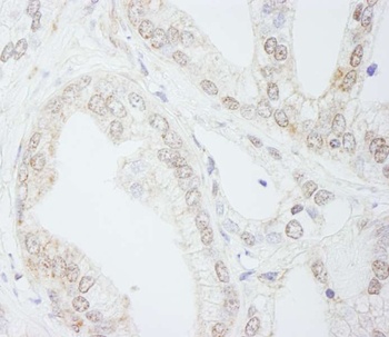 Rabbit METTL3/MT-A70 Antibody