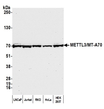 Rabbit METTL3/MT-A70 Antibody