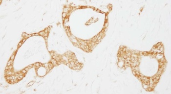 Rabbit USP3 Antibody