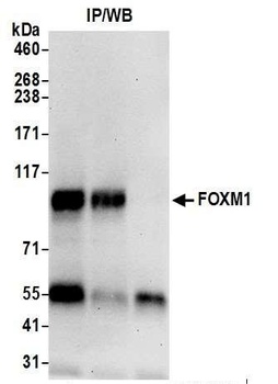 Rabbit FOXM1 Antibody