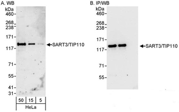 Rabbit SART3/TIP110 Antibody