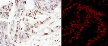 Rabbit SART3/TIP110 Antibody