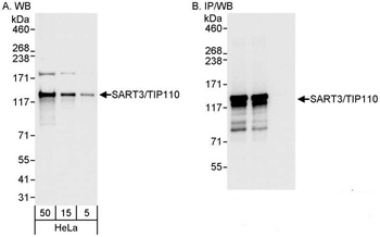Rabbit SART3/TIP110 Antibody