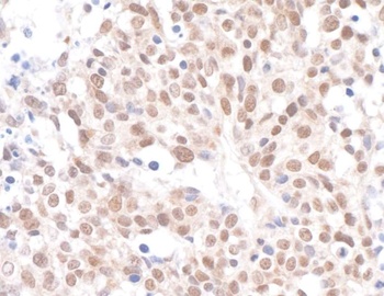Rabbit Caf1p150 Antibody