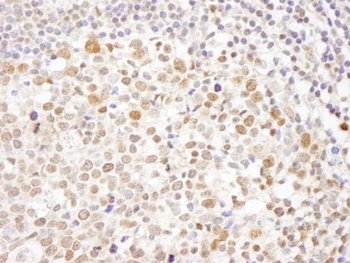 Rabbit Caf1p150 Antibody