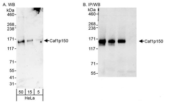 Rabbit Caf1p150 Antibody