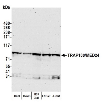 Rabbit TRAP100/MED24 Antibody