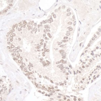 Rabbit NP95/UHRF1 Antibody