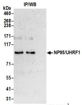 Rabbit NP95/UHRF1 Antibody