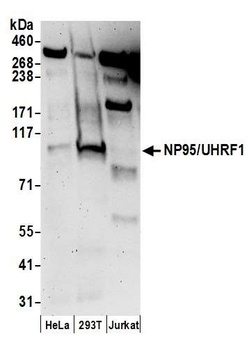 Rabbit NP95/UHRF1 Antibody