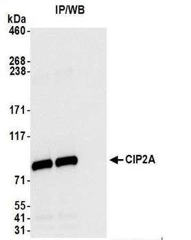 Rabbit CIP2A Antibody