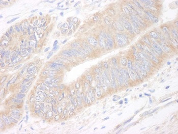 Rabbit CIP2A Antibody