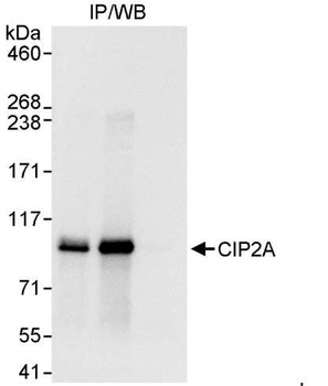Rabbit CIP2A Antibody