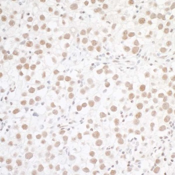 Rabbit WTAP Antibody