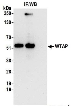Rabbit WTAP Antibody