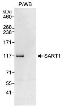 Rabbit SART1 Antibody