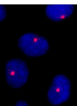 Rabbit CEP131/AZ1 Antibody