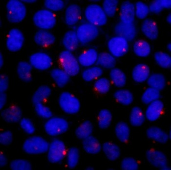 Rabbit CEP131/AZ1 Antibody