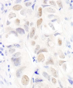 Rabbit Anillin Antibody