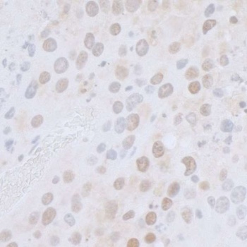Rabbit CTR9 Antibody