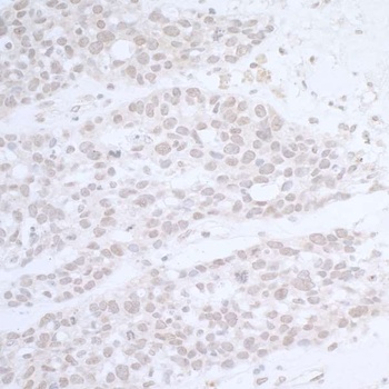 Rabbit CTR9 Antibody