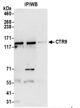 Rabbit CTR9 Antibody