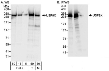 Rabbit USP9X Antibody