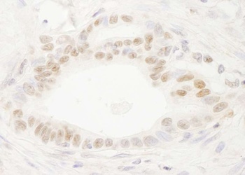Rabbit DEK Antibody