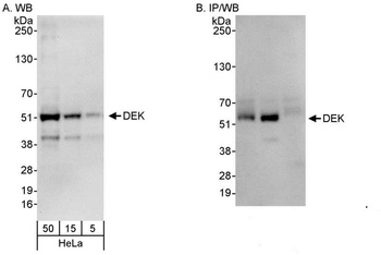 Rabbit DEK Antibody