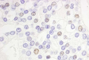 Rabbit DEK Antibody