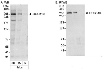 Rabbit DOCK10 Antibody