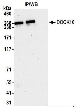 Rabbit DOCK10 Antibody