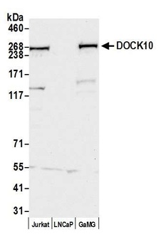 Rabbit DOCK10 Antibody