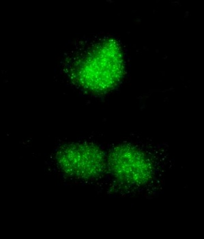 Rabbit RCOR3 Antibody