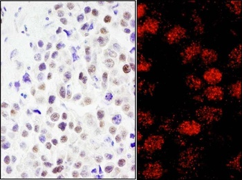 Rabbit RCOR3 Antibody