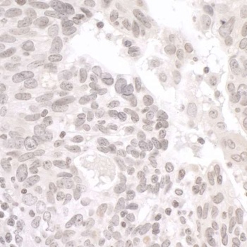 Rabbit PALB2 Antibody