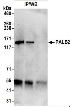 Rabbit PALB2 Antibody