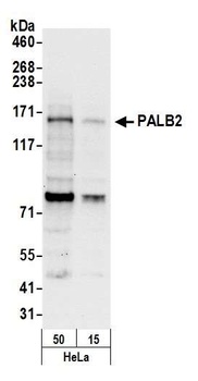 Rabbit PALB2 Antibody