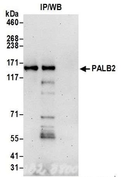 Rabbit PALB2 Antibody