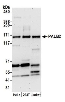 Rabbit PALB2 Antibody