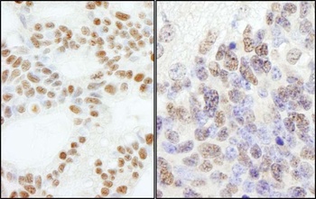 Rabbit PolE3/p17 Antibody