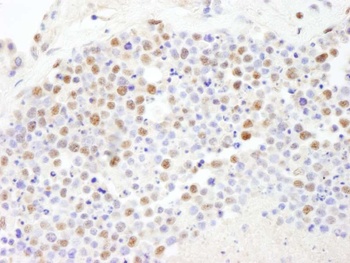 Rabbit PolD3/p66 Antibody