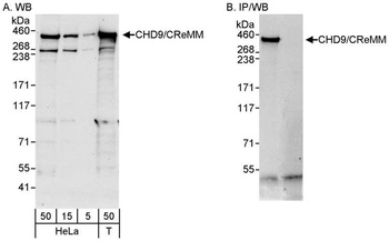 Rabbit CHD9/CReMM Antibody