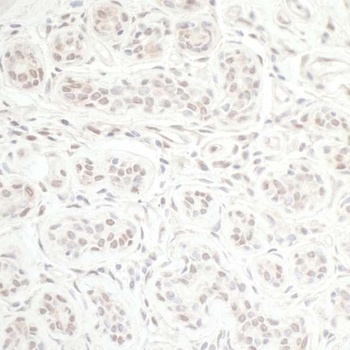 Rabbit CHD8 Antibody